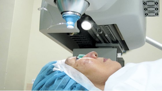 novyj etap v rossijskoj oftalmokhirurgii katarakty