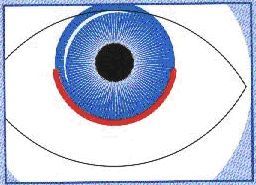 Методы оперативного удаления катаракты