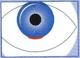 Методы оперативного удаления катаракты